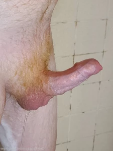 5586520