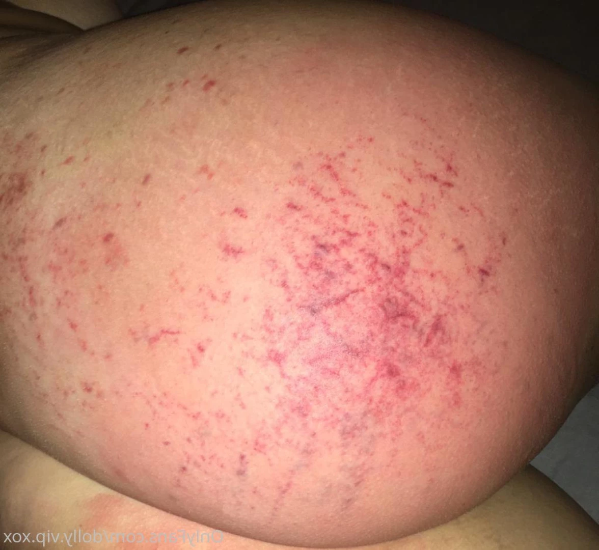 ℳ𝒾𝓈𝓈 𝒟ℴ𝓁𝓁𝓎 . [ missdollyexclusive ] Onlyfans leaked photo 5560028 on Hotleaks.tv