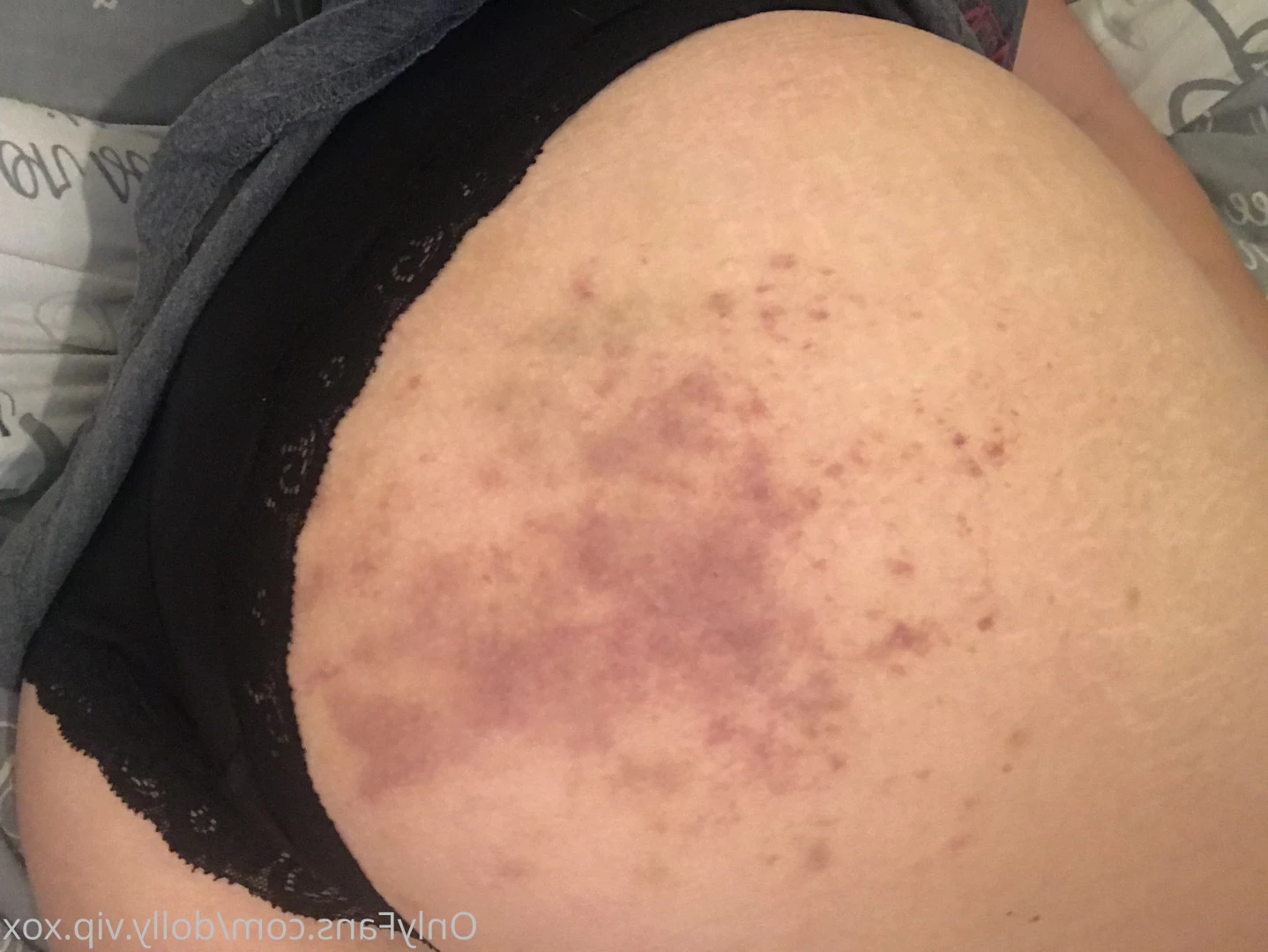 ℳ𝒾𝓈𝓈 𝒟ℴ𝓁𝓁𝓎 . [ missdollyexclusive ] Onlyfans leaked photo 5560086 on Hotleaks.tv