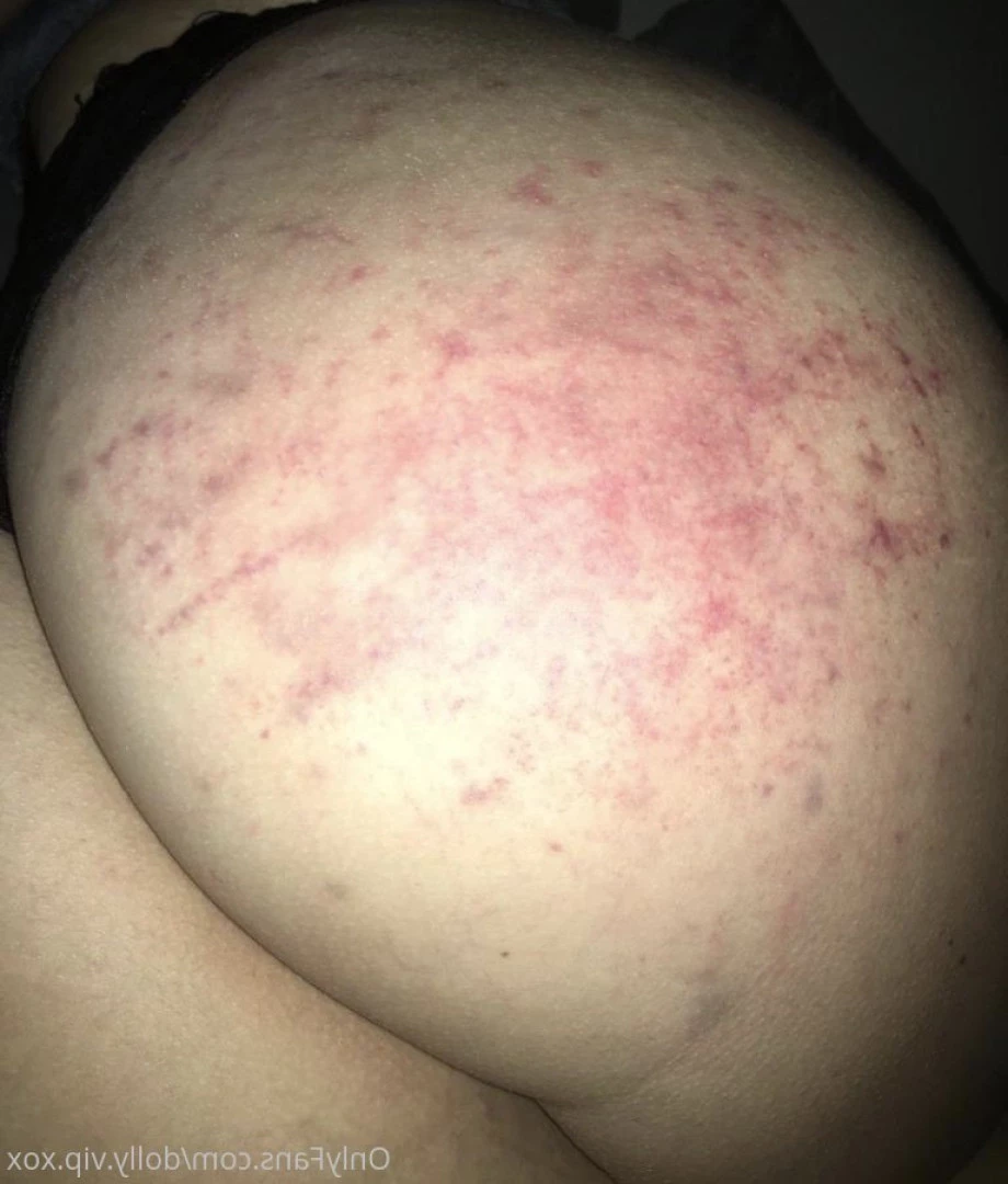 ℳ𝒾𝓈𝓈 𝒟ℴ𝓁𝓁𝓎 . [ missdollyexclusive ] Onlyfans leaked photo 5560327 on Hotleaks.tv