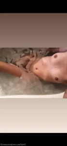 5555418