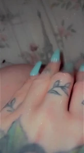 10572161