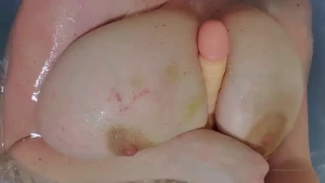 10571364