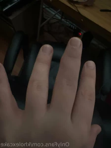 15136261