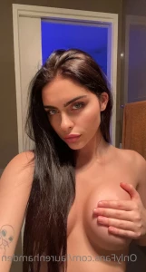5704618