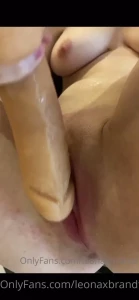 5176612