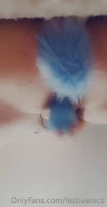 15521404