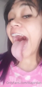 5178382