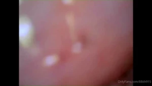 10570635