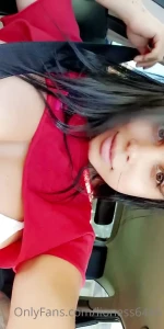 5181778