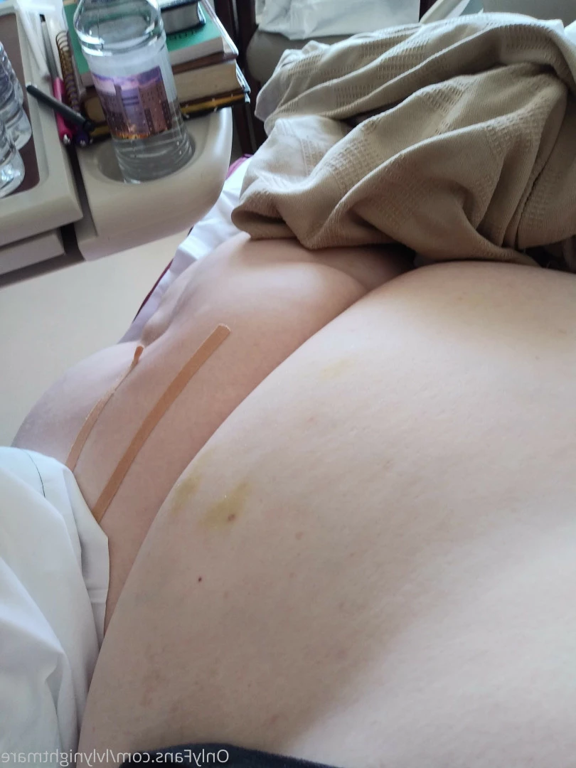 Kirby [ lvlynightmare ] Onlyfans leaked photo 10831973 on Hotleaks.tv