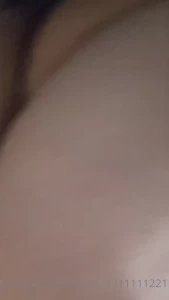 5198315