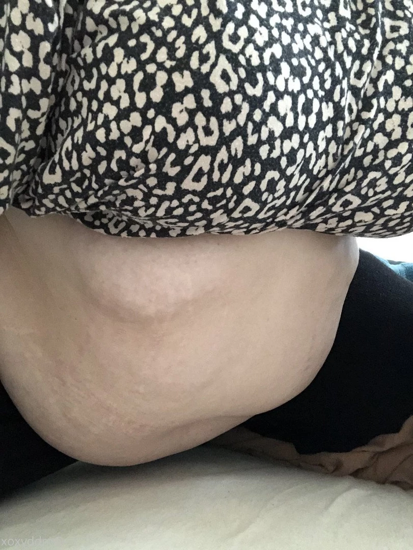molly [ mbbyxox ] Onlyfans leaked photo 5413569 on Hotleaks.tv
