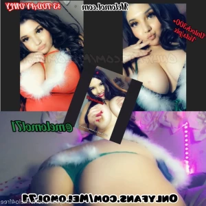 15415308