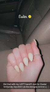 5240318