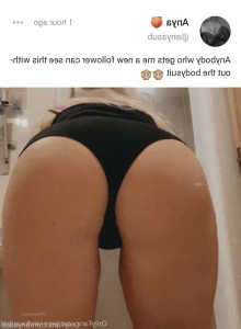 5152418
