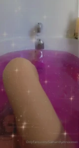 8642770
