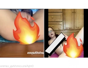 4990931