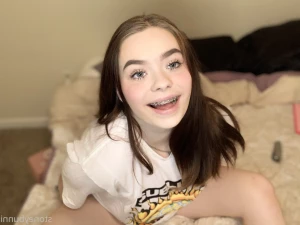 4923736