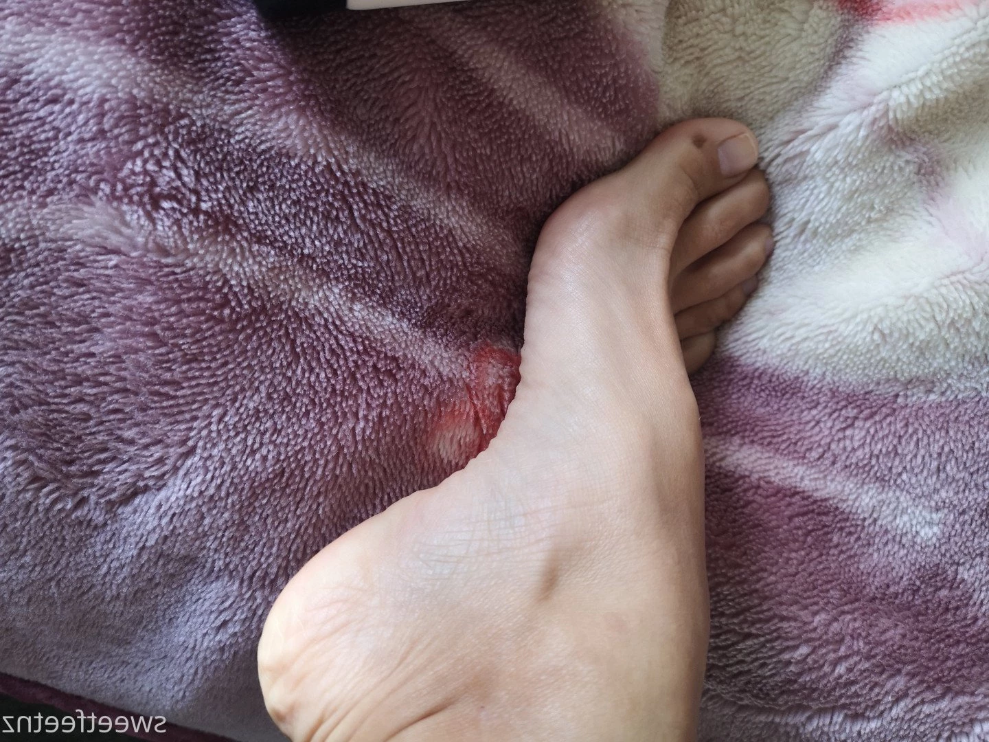 Sweet Feet NZ [ sweetfeetnz ] Onlyfans leaked photo 4970714 on Hotleaks.tv