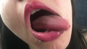 8632245