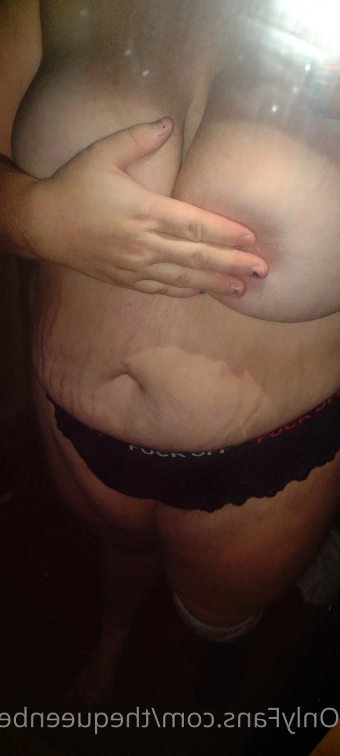 TheQu33nOfAmputations [ thequeenbee69 ] Onlyfans leaked photo 5013465 on Hotleaks.tv