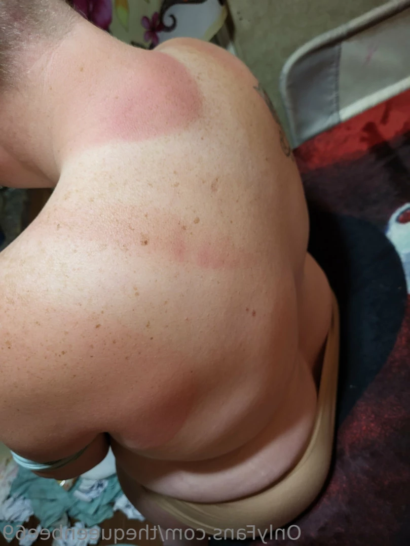 TheQu33nOfAmputations [ thequeenbee69 ] Onlyfans leaked photo 15021286 on Hotleaks.tv