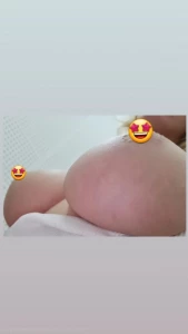 4918544