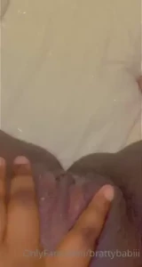 18255776
