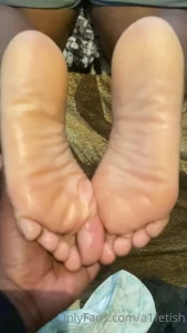 7772372