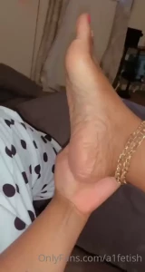 7772380