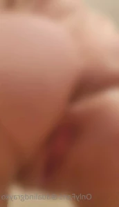 6476513