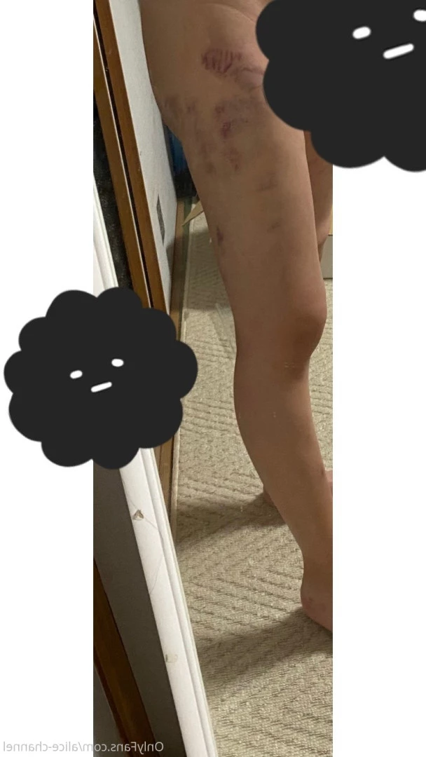 Alice [ alice_monthly_fans ] Onlyfans leaked photo 7723818 on Hotleaks.tv