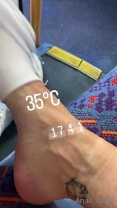7767171
