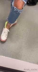 7767176