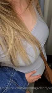 7764663