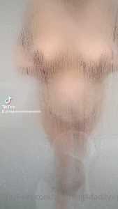7764670