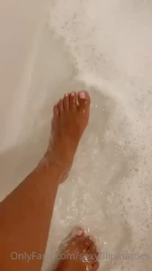 7762655