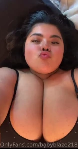 7761709