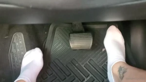 7761157
