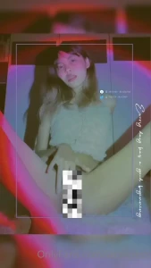 7756131