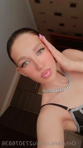 7620002