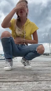 7752533