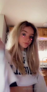 15869280