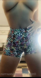 7664867