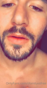 7725171