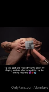 7725206