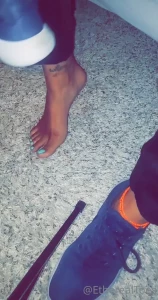 7687775
