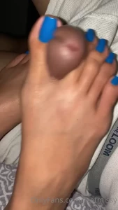 7662791