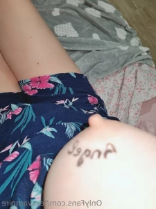 14665907